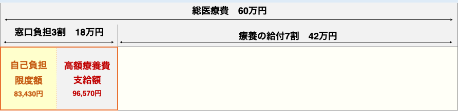 計算例